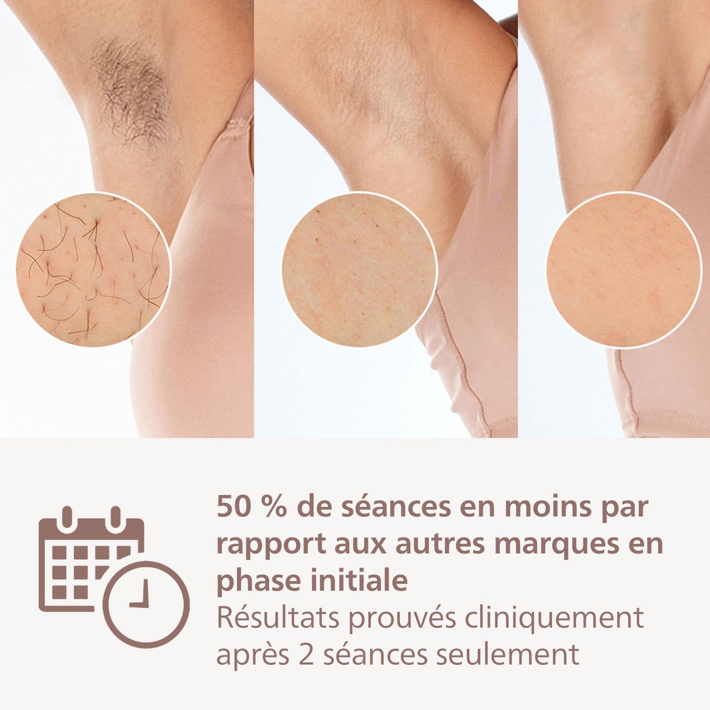 Philips Lumea série 8000, Épilateur à lumière pulsée, alternative à l'épilation laser, technologie SenseIQ, 4 accessoires pour le corps, le visage, le maillot et les aisselles, modèle BRI948/00